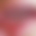Aphthen habituelle: in regelmäßigen Zeitabständen auftretende flache weißlich Fibrin-bedeckte Sch...