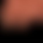 Pachyonychia congenita: alle Finger- und Zehennägel betreffende, angeborene Nageldystrophie mit P...