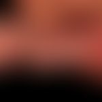 Hämangiomatose&nbsp;des Säuglings: (s.a.folgende Abbildungen)
