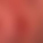Hämangiomatose&nbsp;des Säuglings: (s.a.folgende Abbildungen)
