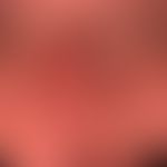 Hämangiomatose&nbsp;des Säuglings:&nbsp;rote unregelmäßig verteilte Knötchen und fokale Abblassun...