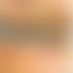 Erythema anulare centrifugum: rezidivierende kaum schuppende, zentrifugal wandernde Plaques. Abb....