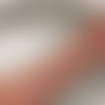 Erythema papulatum centrifugum: flächiges kleinpapulöses Exanthem mit anulären Formationen. Zugru...