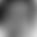 Chloasma/Melasma: beidseitige, chronisch stationäre,&nbsp; symptomlose, braune, glatte Flecken. H...