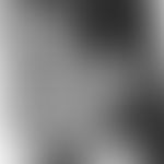 Lupus erythematodes kutaner: chronisch diskoider Lupus erythematodes. Historische Aufnahme. Entno...