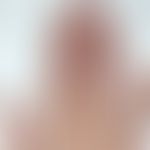 Köhlmeier-Degos-Krankheit assoziativ zu einem systemischenLupus erythematodes. Spritzerartige Atr...
