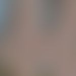 Keratosis lichenoides chronica:&nbsp;knotige Wucherungen.&nbsp;Abb. entnommen aus:&nbsp;&nbsp;Aro...