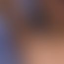 Keratosis lichenoides chronica:&nbsp;streifige und flächige veruköse Plaques bei einem Kind. Abbi...