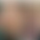 Granulosis rubra nasi: Abbildung entnommen aus:&nbsp;Assefa GT (2023)
