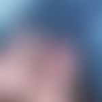 Parakeratosis pustulosa:&nbsp;subunguale und paraunguale Pustulation.&nbsp;&nbsp;Abb. entnommen a...