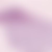 Parakeratosis pustulosa:&nbsp;Akanthose, Papillomatose, subkorneale Pustulbildung.&nbsp;Abb. entn...