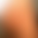 Neutrophiles figuriertes Erythem im Kindesalter: anuläre leicht juckende Plaques. Keine Grundekra...