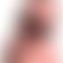 Anuläres Erythem des Säuglings:&nbsp;&nbsp;5 Monate alter Junge mit einer 4-monatigen Vorgeschich...