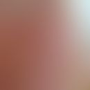Generalisiertes pustulöses figuriertes Erythem nach Hydroxychloroquin-Einnahme. Abb.entnommenn au...