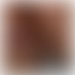 Morbus Crohn, Hautveränderungen: granulomatöse Dermatitis.&nbsp; Abb. entnommen aus:&nbsp;Antonel...