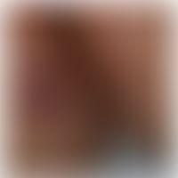 Morbus Crohn, Hautveränderungen: granulomatöse Dermatitis.&nbsp; Abb. entnommen aus:&nbsp;Antonel...