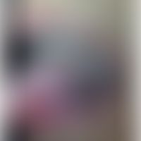 Morbus Crohn, Hautveränderungen: schwere ulzerative (aphthöse) Stomatitis. Abb. entnommen aus:&nb...