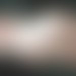 IgA-Pemphigus:&nbsp;zirzinäre Plaques mit Pusteln.&nbsp; Abb. entnommen aus:&nbsp;&nbsp;Kerroum S...