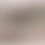 IgA-Pemphigus: Pralle Blasen und Half and Half-Blisters (Hypopyon-Pusteln).&nbsp; Abb. entnommen ...