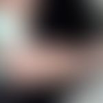 Eczema coxsackium: Vesikulöses Exanthem (pyodermisiert) bei atopischer Dermatitis. Abb. entnommen...