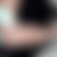 Eczema coxsackium: Vesikulöses Exanthem (pyodermisiert) bei atopischer Dermatitis. Abb. entnommen...