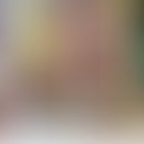 CHILD-Syndrom: unilateraler&nbsp;verruköser Naevus.&nbsp; Abb. entnommen aus&nbsp;Maceda EBG et a...