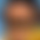 Megalencephaly-Capillary Malformation-Polymicrogyria Syndrom (Abb. entnommen aus:&nbsp;Sarma K et...