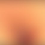 Hamartom ekkrines angiomatöses: auflichtmikroskopische Darstellung mit sinusoidal erweitereten Ka...