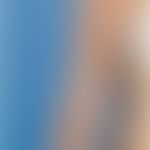 Atrophodermia linearis: bandförmige Atrophodemie bei einr jungen Patienten. Abb. entnommen aus:&n...
