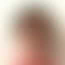 Facial Dysmorphism, Immunodeficiency, Livedo, and Short Stature: Abb. entnommen aus:&nbsp;Jiang L...