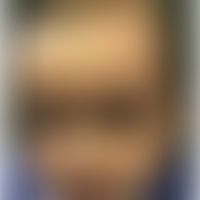 Differenzialdiagnose Epheliden: Xeroderma pigmentosum. Abb. entnommen aus:Pradillo Martín MC et a...