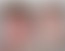 ISQMR: flächige Erytheme mit diffuser Abschuppung der Haut (primär Kollodiumbaby). Abb. entnommen...