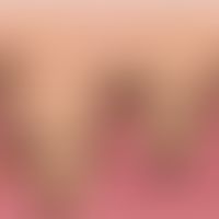 Epidermis-Melanin-Einheit: Die organoide&nbsp;Epidermis-Melanin-Einheit besteht aus einem Melanoz...