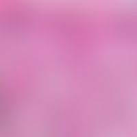 Epidermis -Melanin-Einheit: Pathologisch veränderte&nbsp;Epidermis -Melanin-Einheit durch Prolife...