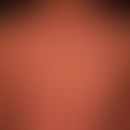 Mikroskopische Polyangiitis: Bizarre ortstreue, symptomlose Erytheme
