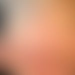 Anstrengungsurtikaria: 20 min. nach körperlicher Anstrengung auftretendes urtikarielles Exanthem....