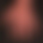 Dermatomyositis: Hände bei schwerer Dermatomyositis; Akrozynaose, Onachogrypose, Onycholyse
