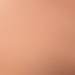 Differenzialdiagnose:&nbsp;Frontale fibrosierende Alopezie

Diagnose: Alopecia areata (Kadaverhaa...