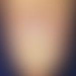 Waschbrettnägel: Tief eingezogene Querrillungen bei Habit-Tic Deformity.&nbsp;&nbsp;
