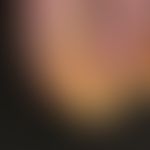 Onychogrypose bei schwerer Psoriasis und vernachlässigter Nagelhygiene
