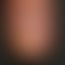 Ölfleck mit beginnender distalen Onycholyse, erkennbar an der Auffaserung der ursprünglich scharf...
