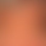 Hautalterung: Cutis rhomboidalis nuchae bei einm 75.-Jährigen.&nbsp;
