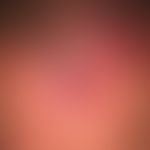 Primär kutanes B-Zell-Lymphom:&nbsp;Seit mehreren Monaten langsam wachsende, livid-rote, derbe&nb...