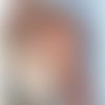 Histiozytose intralymphatische: Asymptomatische, streifige und flächenhafte rote und bräunliche F...