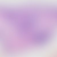 Histiozytose intralymphatische:&nbsp;Histologischer&nbsp; Befund mit knotigen lymphozytären Infil...