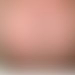 Pemphigus foliaceus, endemischer: Schwere, generalisierte&nbsp;(erythrodermische)&nbsp; Form der ...
