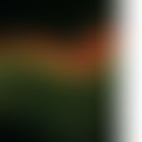 Pemphigus foliaceus, endemischer:&nbsp;Bei aktiver Erkrankung immer nachweisbare Ablagerungen von...
