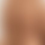 Grinspan-Syndrom: Klinische Zeichen des Pemphigus vulgaris. Abb. entnommen aus: Saddik A et al. 2...