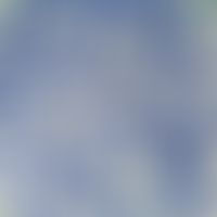 Keratinozyten mit durch die histologisch bedingte Fixierung Spike-artig geschrumpften Zellkontakte.
