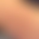 Erythema chronicum migrans: seit wenigen Wochen bestehendes zentrifugal scih ausbreitendes Erythe...